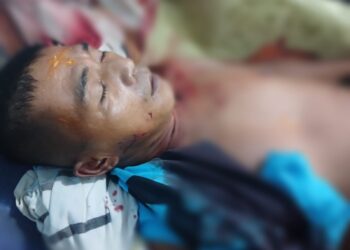 Diterkam Buaya, Seorang Warga Kritis Di Pulau Banyak Barat