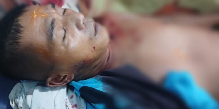 Diterkam Buaya, Seorang Warga Kritis Di Pulau Banyak Barat