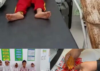 Keracunan Makanan, 9 Murid Dilarikan Ke Puskemas