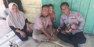 Kapolres Aceh Singkil Berikan Bantuan Operasi Untuk Anak Penderita Bibir Sumbing