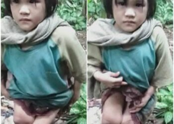 Kisah Pilu Anak 10 Tahun Di Desa Hilikara Nias Selatan