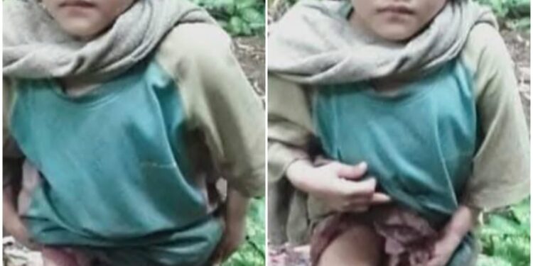 Kisah Pilu Anak 10 Tahun Di Desa Hilikara Nias Selatan