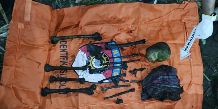 Temuan Kerangka Manusia di Evakuasi Satreskrim Polres Aceh Timur