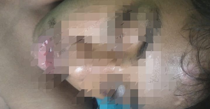 Korban Penganiayaan Dipulangkan Dari Rumah Sakit karena Tak Mampu Bayar Biaya Perawatan