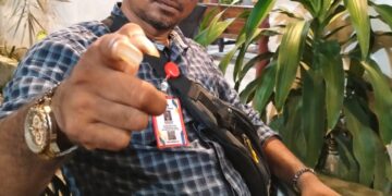 Adik Dianiaya, Rimung Buloeh Minta PT Banda Aceh Jangan Kabulkan Banding Oknum Reje Di Aceh Tengah