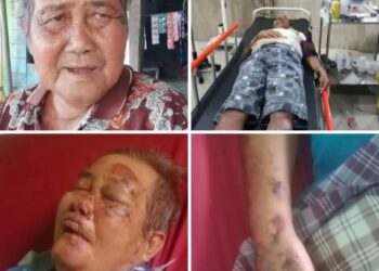 Hamdan Jauhari Perantau Asal Bandung Terlantar Di Rimo, Terbaring Sendiri Di RSUD Usai Kecelakaan