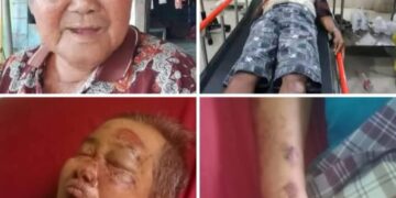 Hamdan Jauhari Perantau Asal Bandung Terlantar Di Rimo, Terbaring Sendiri Di RSUD Usai Kecelakaan