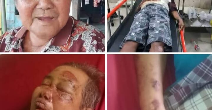 Hamdan Jauhari Perantau Asal Bandung Terlantar Di Rimo, Terbaring Sendiri Di RSUD Usai Kecelakaan