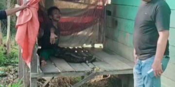 Anak Berkebutuhan Khusus di Langsa Butuh Perhatian Serius Pemerintah